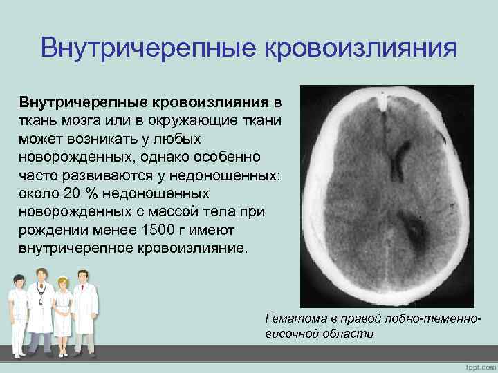 Внутричерепные кровоизлияния в ткань мозга или в окружающие ткани может возникать у любых новорожденных,