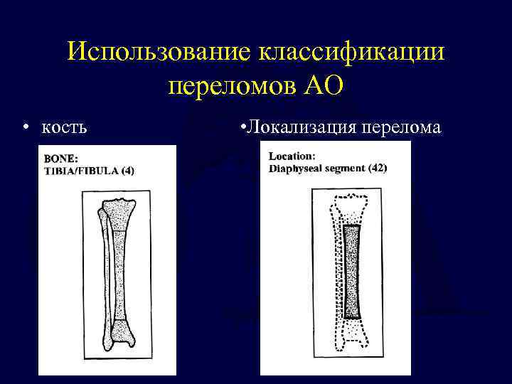 Классификация переломов лопатки рисунок