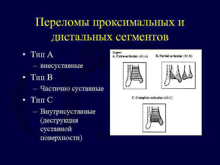 Тип сегментов