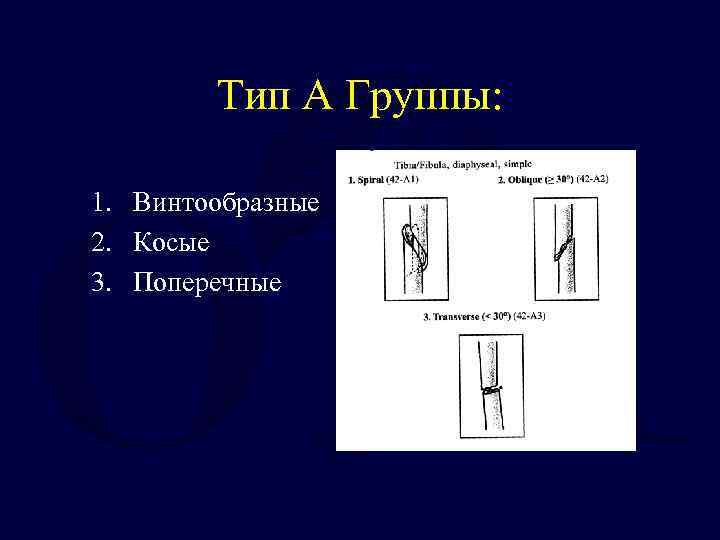 Тип A Группы: 1. Винтообразные 2. Косые 3. Поперечные 