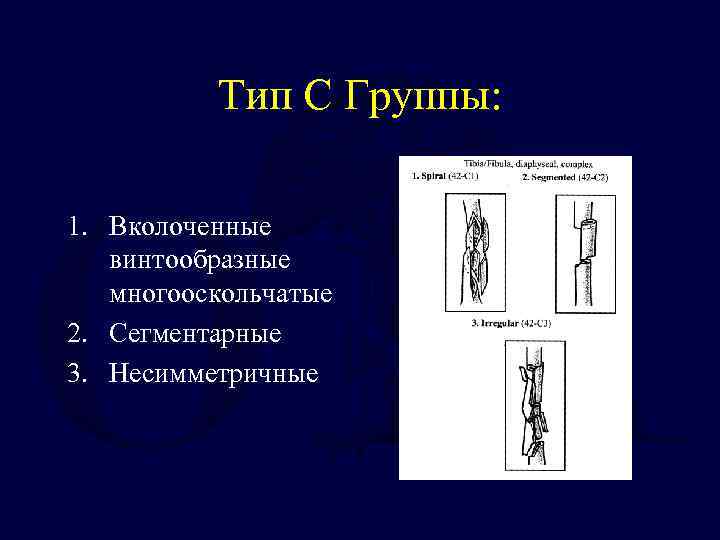 Тип C Группы: 1. Вколоченные винтообразные многооскольчатые 2. Сегментарные 3. Несимметричные 