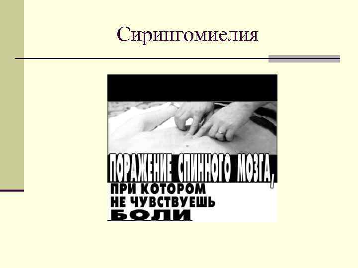 Сирингомиелия 