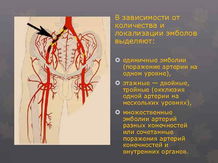 В зависимости от количества и локализации эмболов выделяют: единичные эмболии (поражение артерии на одном