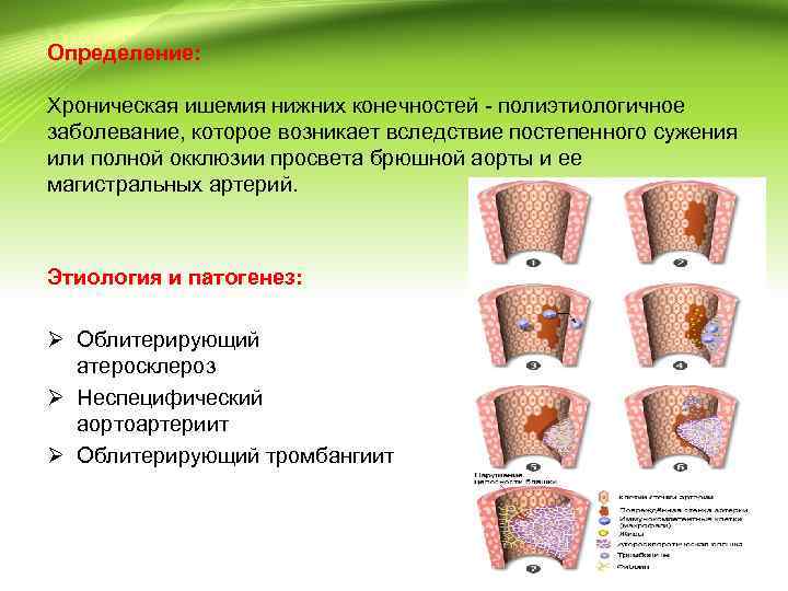 Ишемия конечности классификация. Ишемия нижних конечностей классификация. Определение критической ишемии нижних конечностей. Степени ишемии конечности.