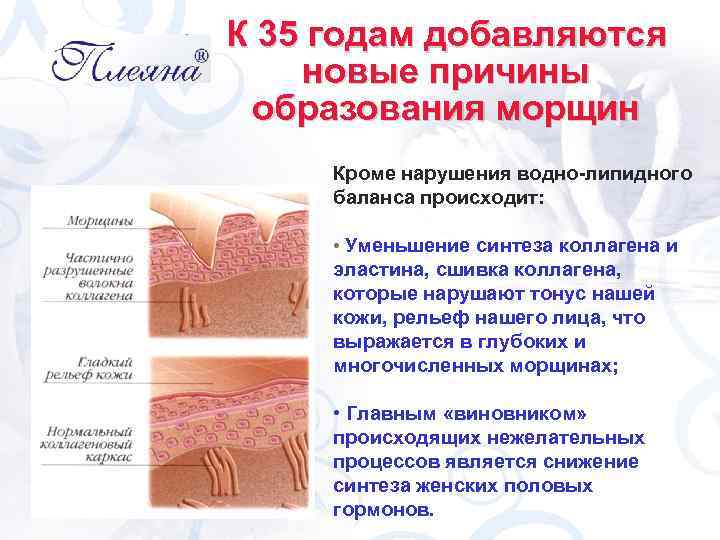 К 35 годам добавляются новые причины образования морщин Кроме нарушения водно-липидного баланса происходит: •