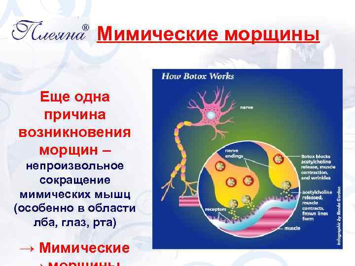 Мимические морщины Еще одна причина возникновения морщин – непроизвольное сокращение мимических мышц (особенно в