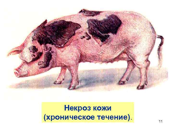 Некроз кожи (хроническое течение). 11 