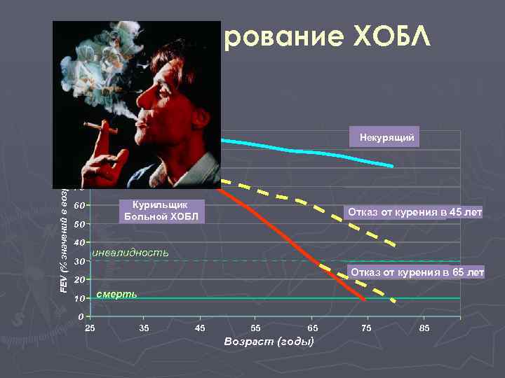 FEV (% значений в возрасте 25 лет Прогрессирование ХОБЛ 100 Некурящий 90 80 70