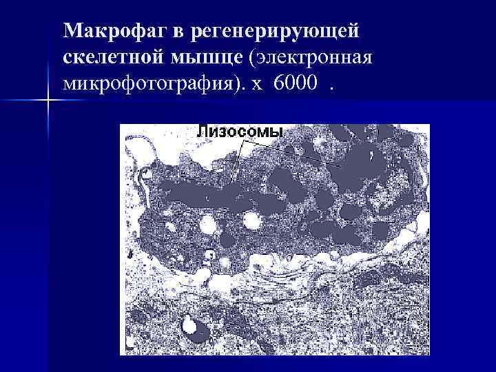 Макрофаг в регенерирующей скелетной мышце (электронная микрофотография). х 6000 . 