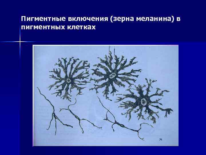 Пигментные включения (зерна меланина) в пигментных клетках 