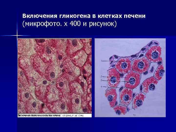 Включения гликогена в клетках печени (микрофото. х 400 и рисунок) 