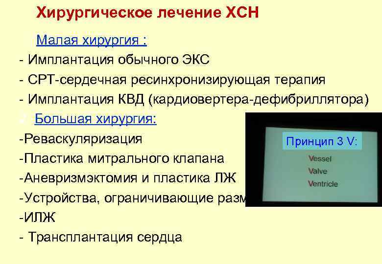 Хирургическое лечение ХСН 1. Малая хирургия : - Имплантация обычного ЭКС - СРТ-сердечная ресинхронизирующая