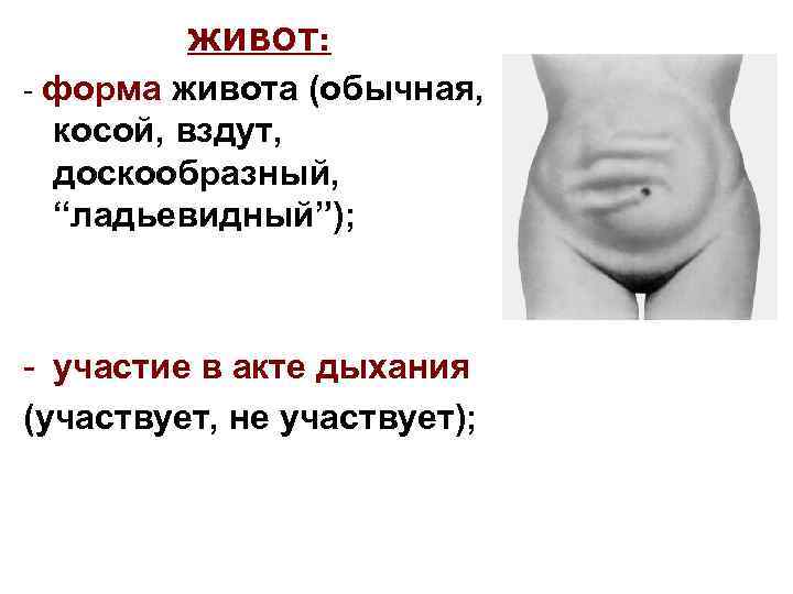 ЖИВОТ: - форма живота (обычная, косой, вздут, доскообразный, “ладьевидный”); - участие в акте дыхания