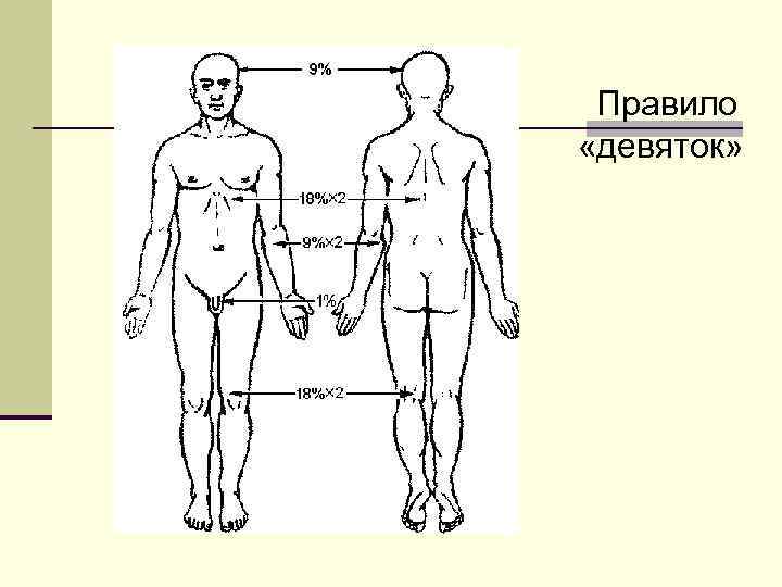 Правило девяток. Правило девяток Уоллеса. Метод Уоллеса при ожогах. Правило Уоллеса площадь ожога. Метод Уоллеса.