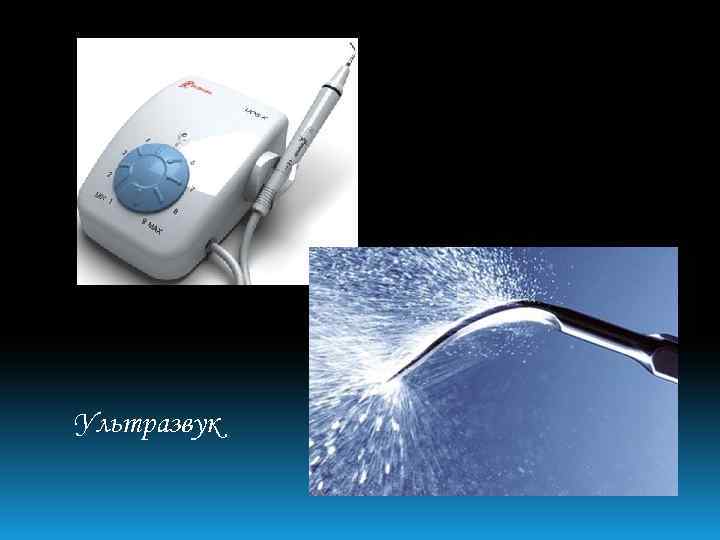 Ультразвук 