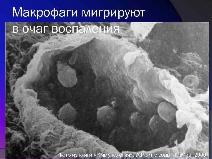 Макрофаги мигрируют в очаг воспаления Фото из книги «Иммунология» , А. Ройт с соавт.