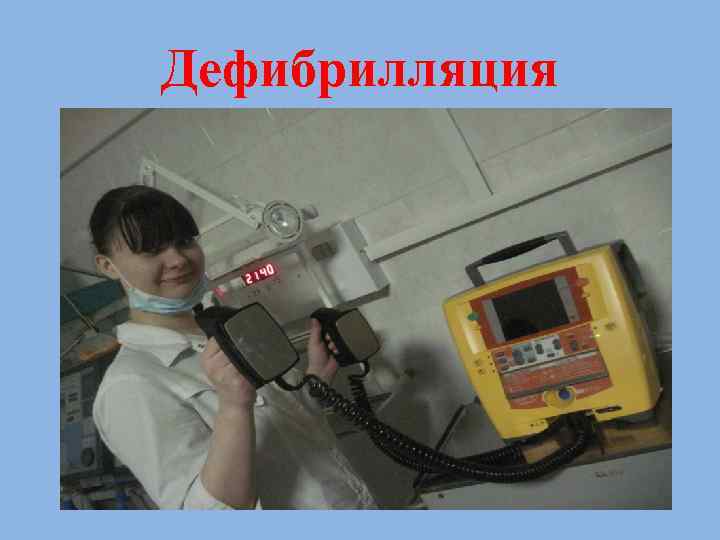 Дефибрилляция 