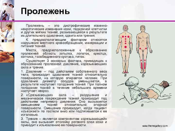 Пролежень – это дистрофические язвеннонекротические изменения кожи, подкожной клетчатки и других мягких тканей, развивающейся