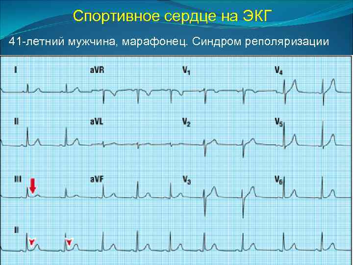 Спортивное сердце презентация