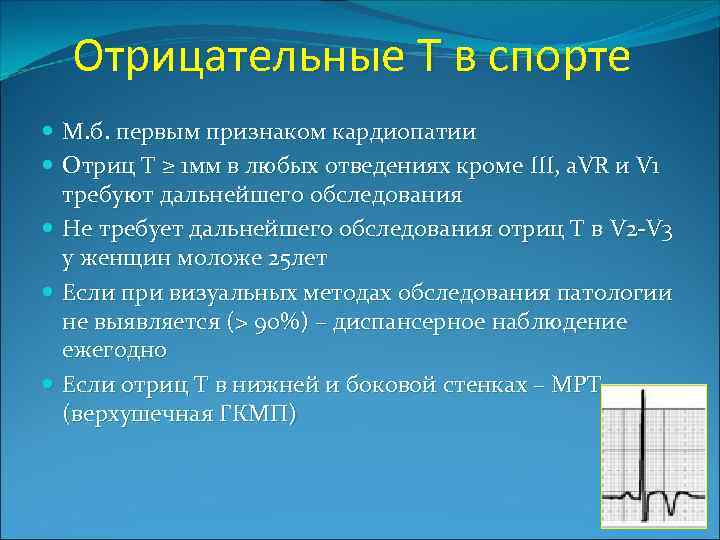 Отрицательные Т в спорте М. б. первым признаком кардиопатии Отриц Т ≥ 1 мм