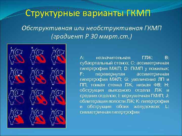 Структурные варианты ГКМП Обструктивная или необструктивная ГКМП (градиент Р 30 ммрт. ст. ) A: