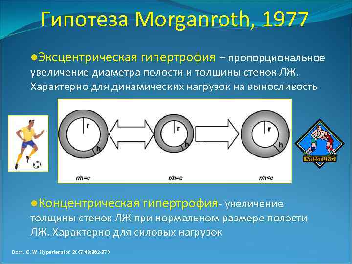 Гипотеза Morganroth, 1977 l. Эксцентрическая гипертрофия – пропорциональное увеличение диаметра полости и толщины стенок