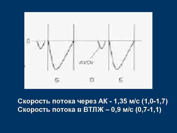 Скорость потока через АК - 1, 35 м/с (1, 0 -1, 7) Скорость потока