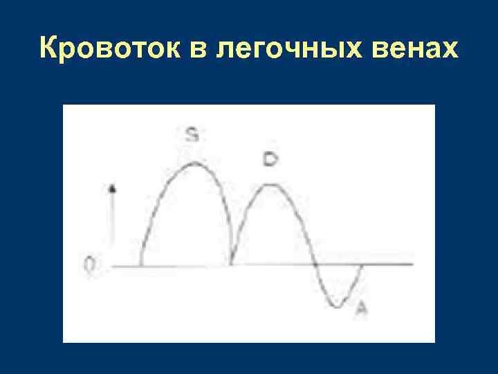Кровоток в легочных венах 