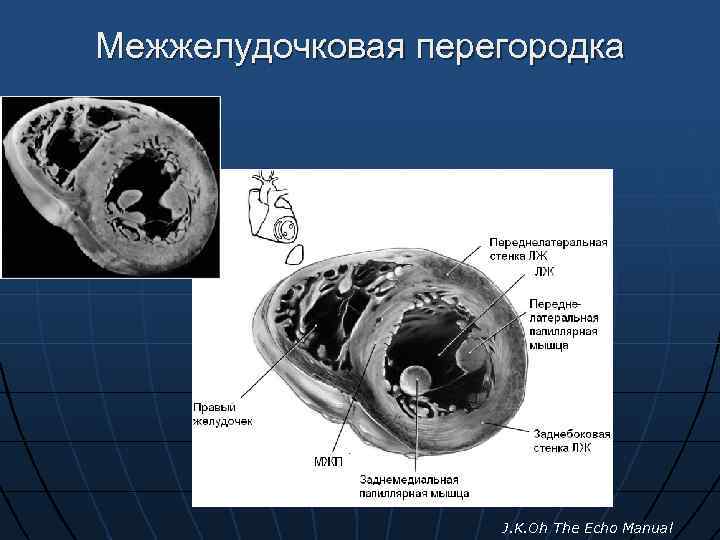 Межжелудочковая перегородка J. K. Oh The Echo Manual 