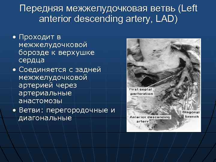 Передняя межжелудочковая ветвь (Left anterior descending artery, LAD) • Проходит в межжелудочковой борозде к