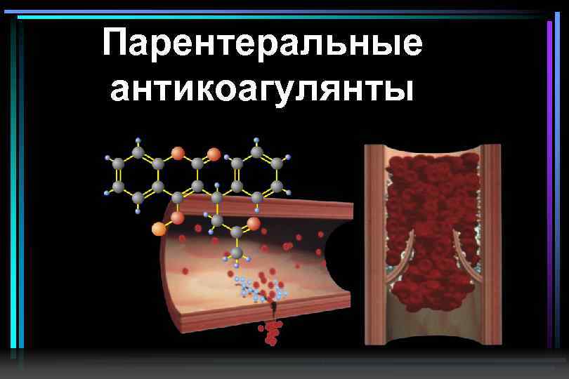Парентеральные антикоагулянты 