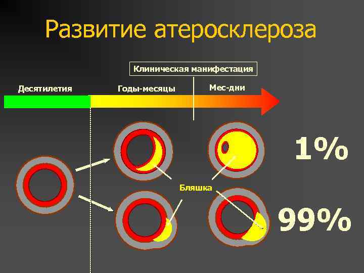 Развитие атеросклероза Клиническая манифестация Десятилетия Годы-месяцы Мес-дни 1% Бляшка 99% 