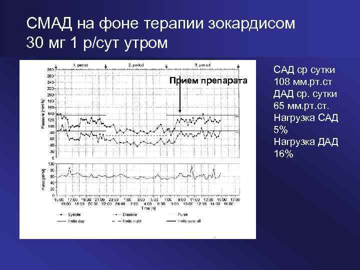 СМАД на фоне терапии зокардисом 30 мг 1 р/сут утром Прием препарата САД ср