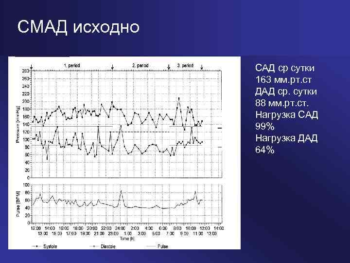 Смад суточный мониторинг давления