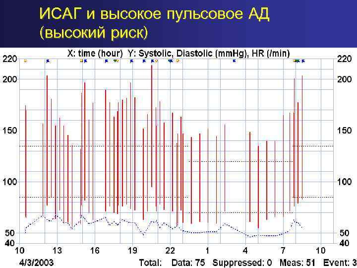 ИСАГ и высокое пульсовое АД (высокий риск) 