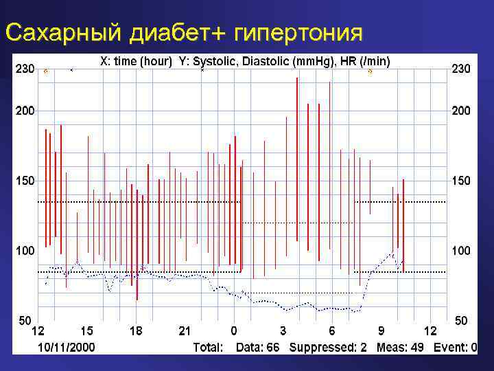 Сахарный диабет+ гипертония 