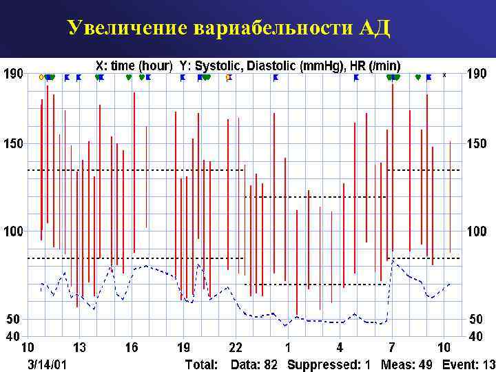 Увеличение вариабельности АД 