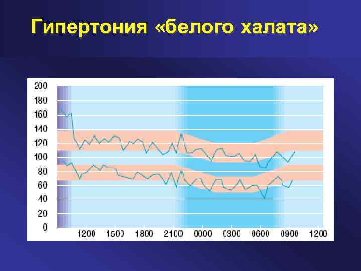 Синдром белого халата