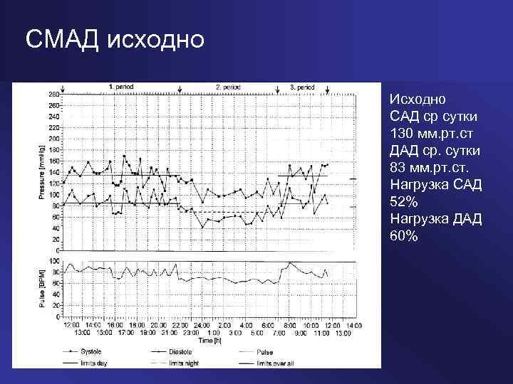 СМАД исходно Исходно САД ср сутки 130 мм. рт. ст ДАД ср. сутки 83