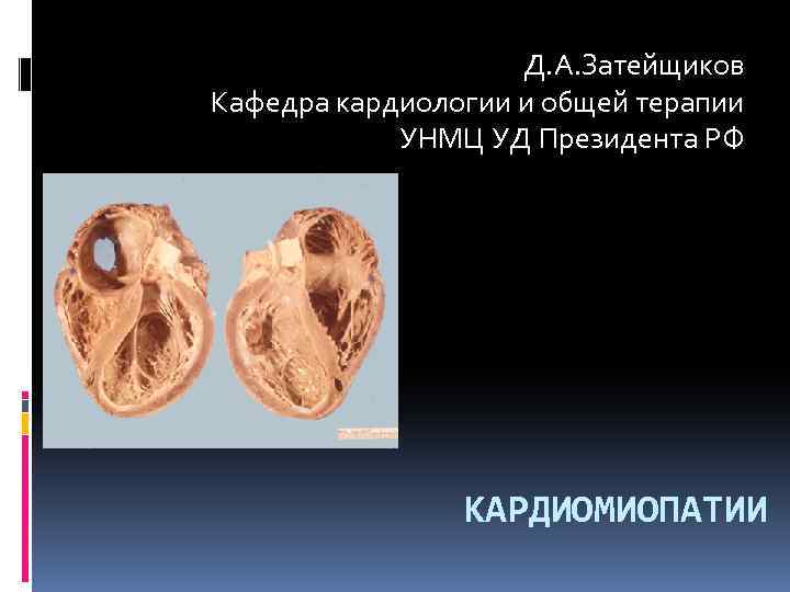 Д. А. Затейщиков Кафедра кардиологии и общей терапии УНМЦ УД Президента РФ КАРДИОМИОПАТИИ 