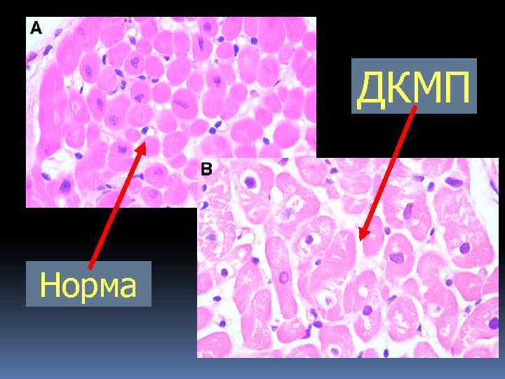 ДКМП Норма 