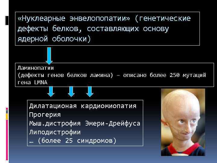  «Нуклеарные энвелопопатии» (генетические дефекты белков, составляющих основу ядерной оболочки) Ламинопатии (дефекты генов белков