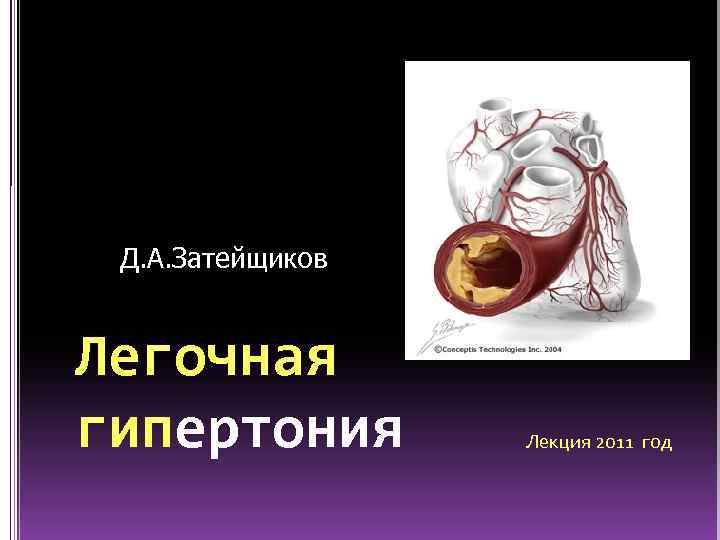Д. А. Затейщиков Легочная гипертония Лекция 2011 год 