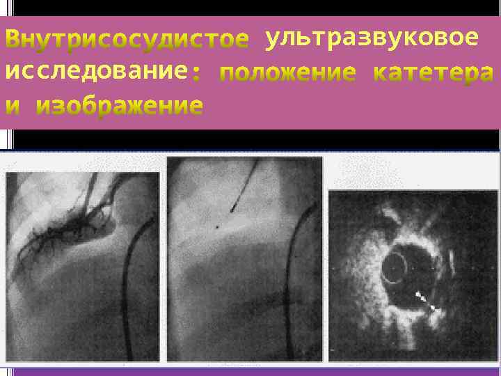 ультразвуковое исследование 