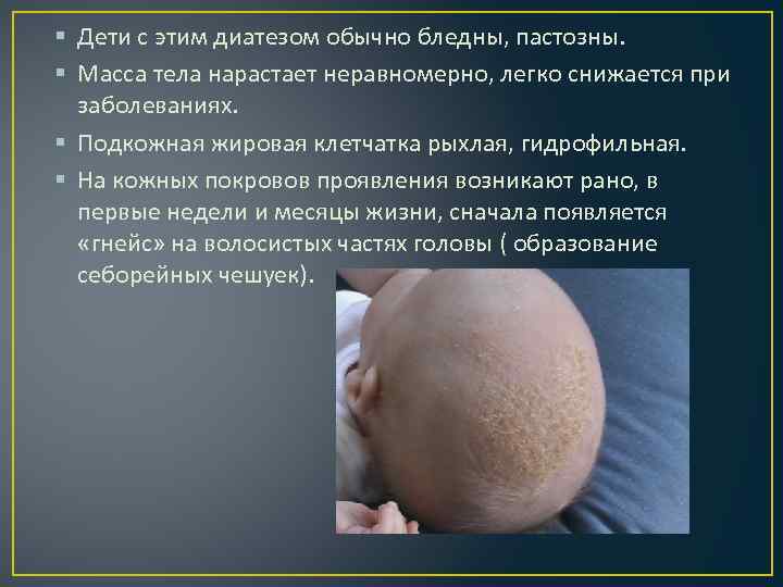 § Дети с этим диатезом обычно бледны, пастозны. § Масса тела нарастает неравномерно, легко