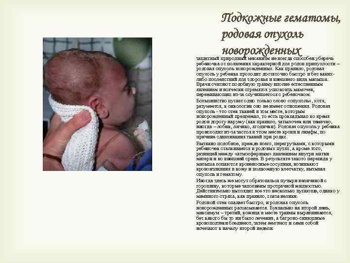 Подкожные гематомы, родовая опухоль новорожденных защитный природный механизм не всегда способен уберечь ребеночка от