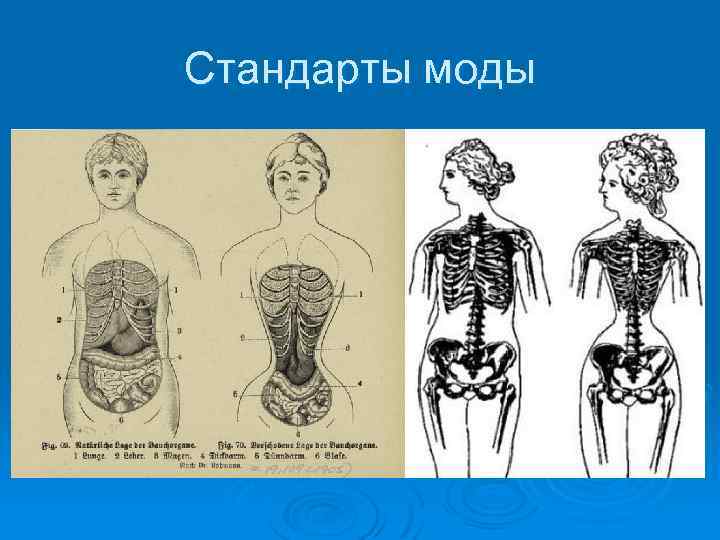 Стандарты моды 