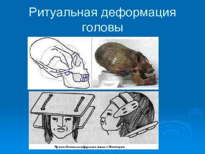 Ритуальная деформация головы 