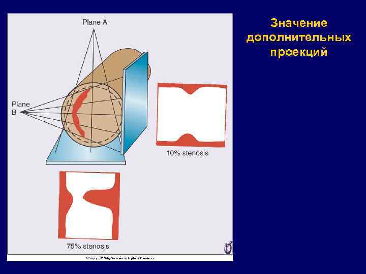 Значение дополнительных проекций 