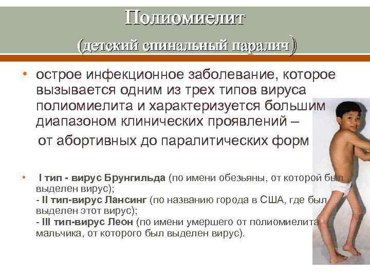 Полиомиелит (детский спинальный паралич) • острое инфекционное заболевание, которое вызывается одним из трех типов